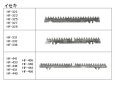 画像2: イセキコンバイン HF  刈取刃 (2)